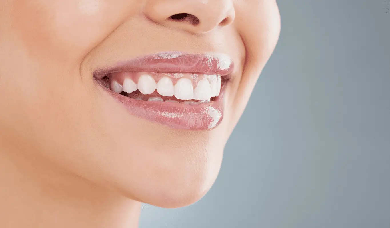 Newport Beach Dentist Dental Crowns