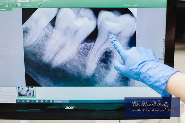 AI dentistry technology and digital X-ray imaging used by Dr. Russell Kelly in Orange, CA