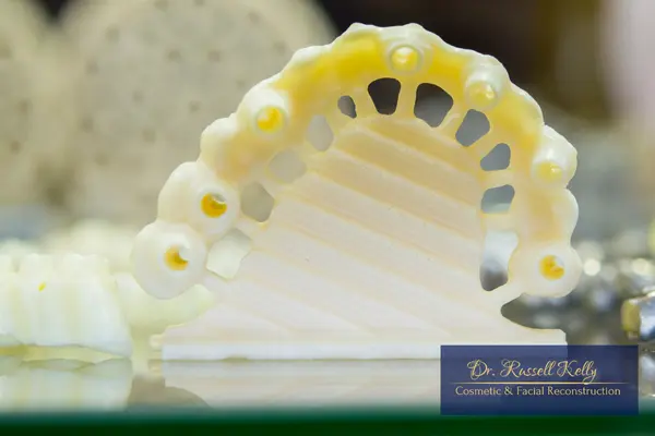 CAD_CAM crown design or AI diagnostics tool used in modern dentistry in Orange, CA